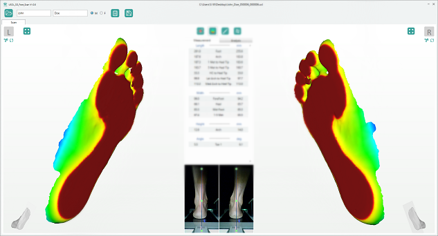 Фото 3D сканер ортопедический USOL (Floor)